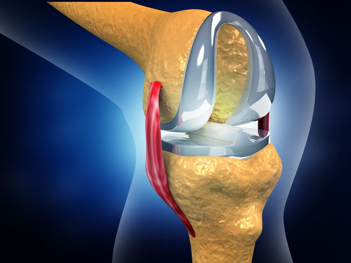 How Long Does Knee Replacement Last?