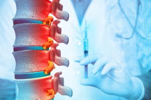 spine injections
